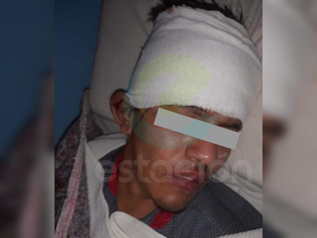 UN MENOR DE CAÑADA DE RÍO PINTO INTERNADO EN TERAPIA INTENSIVA TRAS UNA GOLPIZA