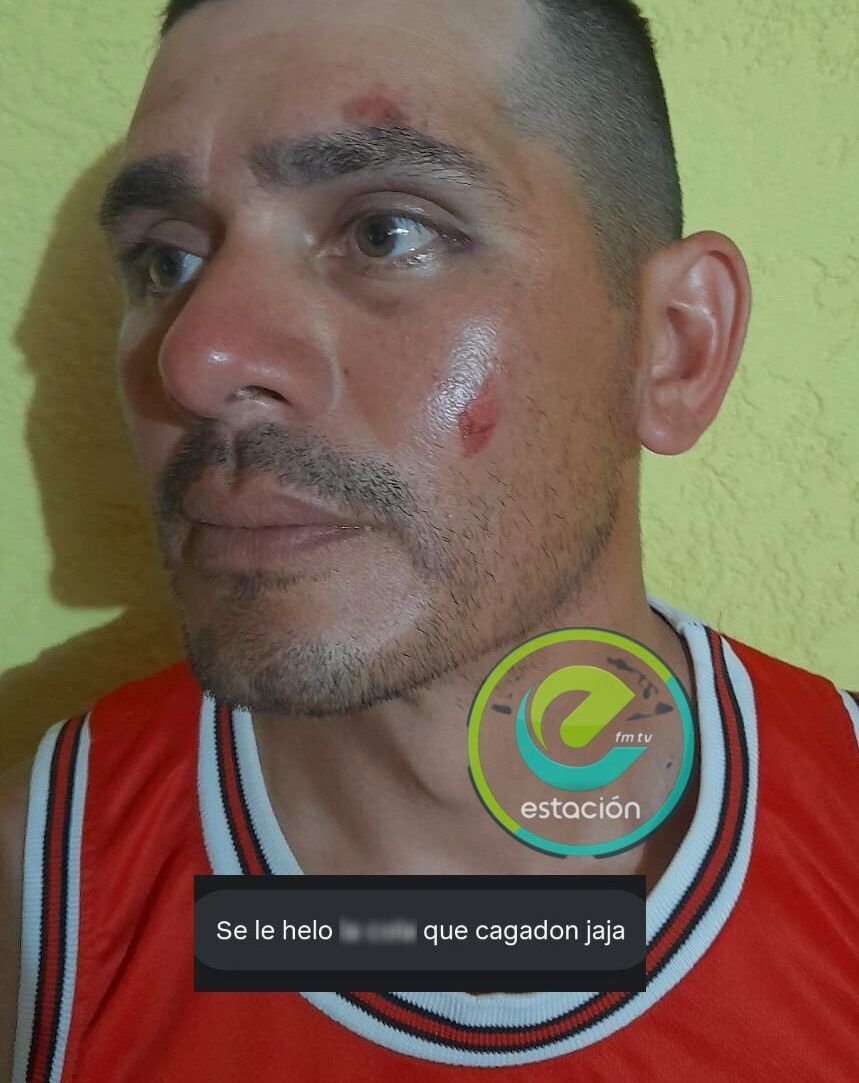 HARTO DEL RUIDO DE LAS MOTOS EN LA MADRUGADA, FUE A RECLAMARLES Y LO PATOTEARON