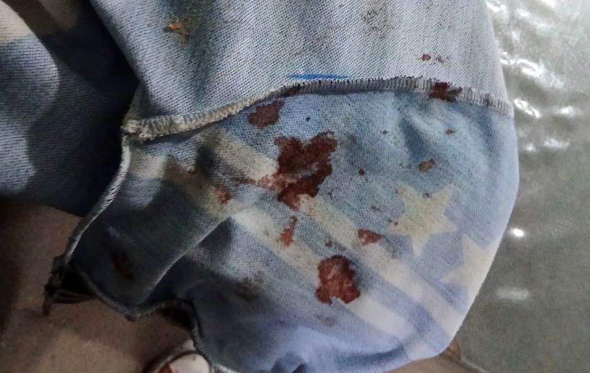 UN NIÑO DE 11 AÑOS SUFRIÓ EL BRUTAL ATAQUE DE UN PERRO QUE YA MORDIÓ A VARIAS PERSONAS EN LA DORMIDA